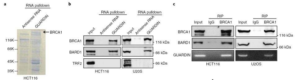 吴缅:lncRNA 神人 2 个月连发 PNAS 和 Nature 子刊