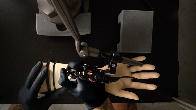 5G powered robot arm needles world