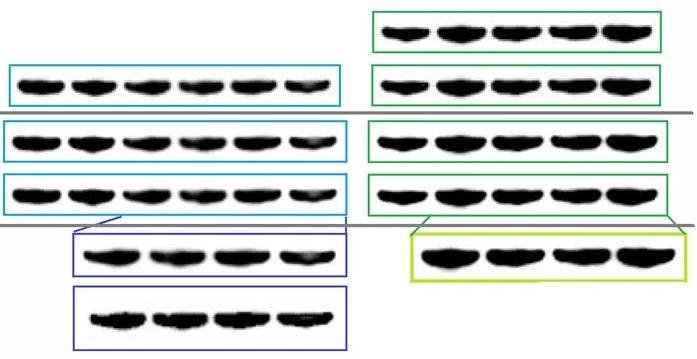 Steven Grant 院士 40 余篇论文被举报学术不端