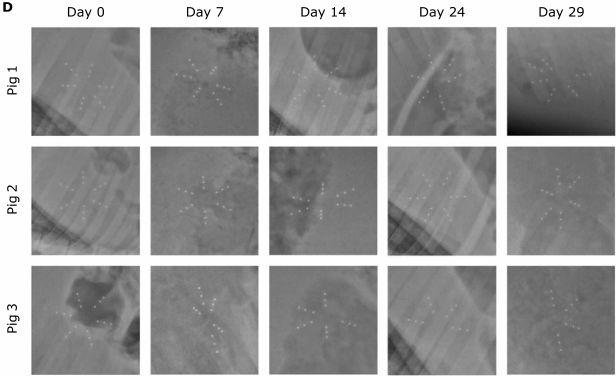 比尔盖茨赞助的女性长效避孕药研发成功 吃 1 粒管 1 个月