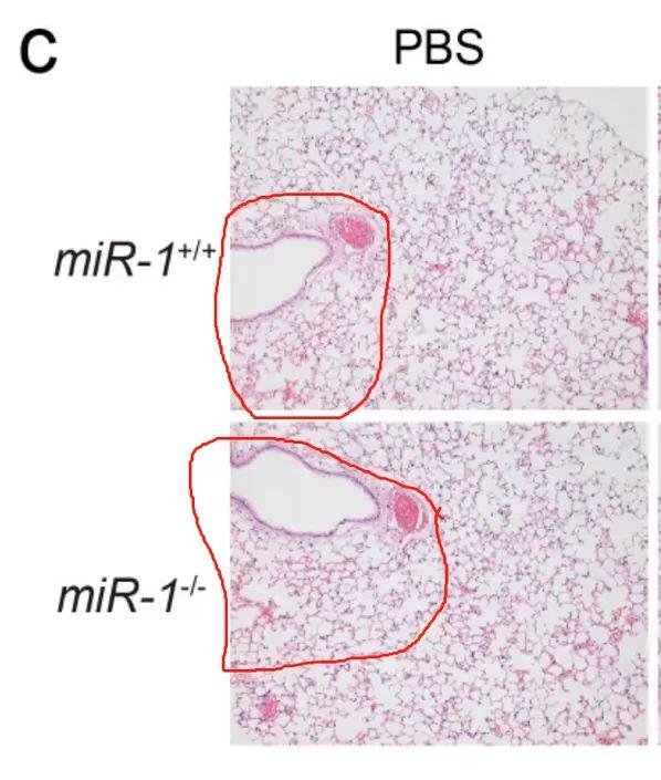 曹雪涛最新论文再遭质疑，受质疑论文总数 64 篇 (附全部名单)