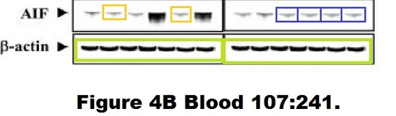 Steven Grant 院士 40 余篇论文被举报学术不端