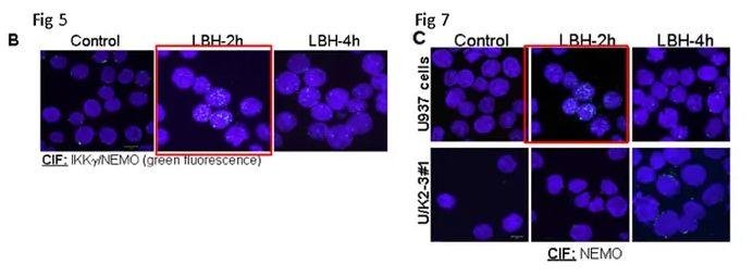Steven Grant 院士 40 余篇论文被举报学术不端