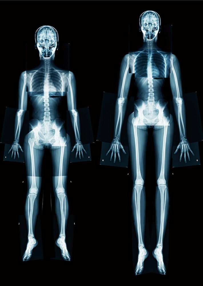 Kumi Kaguraoka 用她的身体重建设备探索美丽标准 Kumi Kaguraoka 用她的身体重建设备探索美丽标准