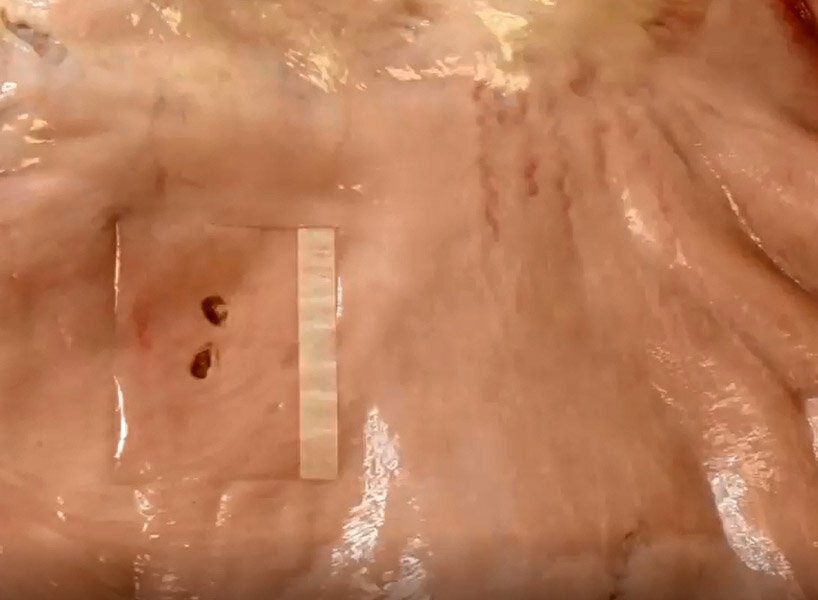 麻省理工学院的工程师开发出用于缝合和手术的外科“管道胶带”