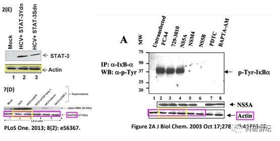 著名肝炎领域专家 Gulam Waris 连续 5 篇文章被撤稿