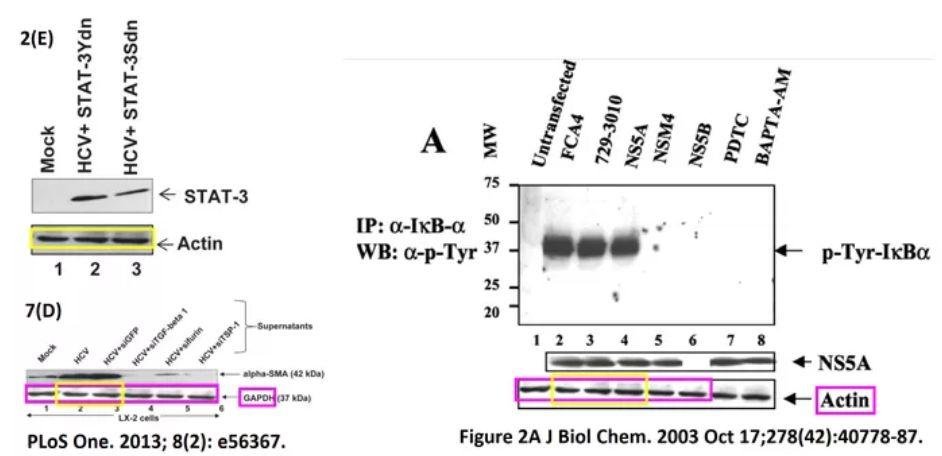 造假牛人 Gulam Waris1 年内才被撤稿 5 篇 SCI！又有 6 篇文章被质疑
