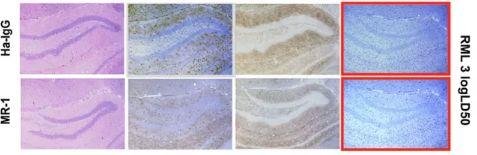 瑞士苏黎世大学医学院 Adriano Aguzzi 教授 9 篇论文涉嫌学术不端