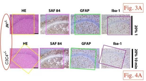 瑞士苏黎世大学医学院 Adriano Aguzzi 教授 9 篇论文涉嫌学术不端
