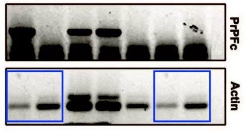 瑞士苏黎世大学医学院 Adriano Aguzzi 教授 9 篇论文涉嫌学术不端