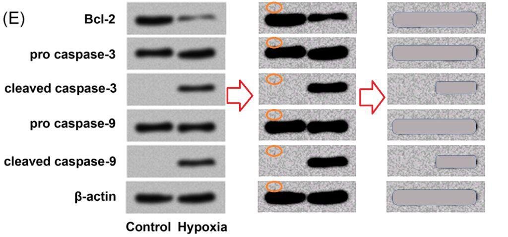 Elisabeth Bik 揭露 400 篇论文思路雷同 多家三甲医院在列 Elisabeth Bik 揭露 400 篇论文思路雷同 多家三甲医院在列