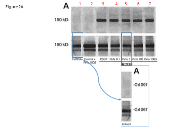 Antonio Benedetti 教授 37 篇署名文章被质疑学术不端